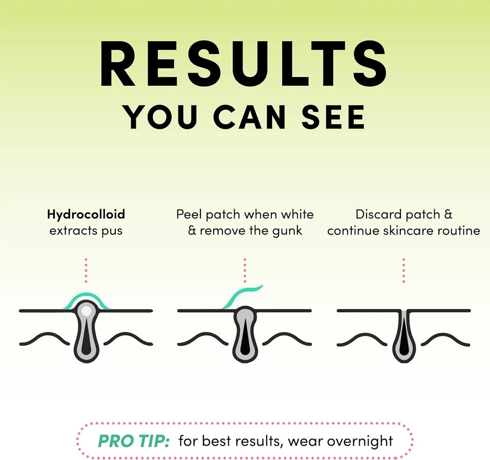 Dots for Spots Invisible Hydrocolloid Patches